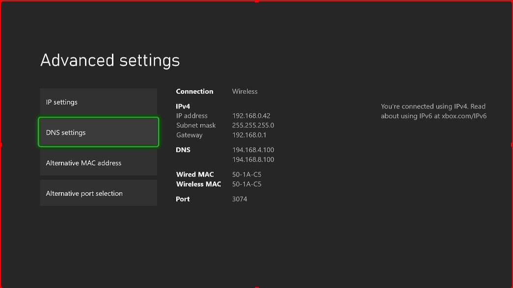 how to change ip address xbox one